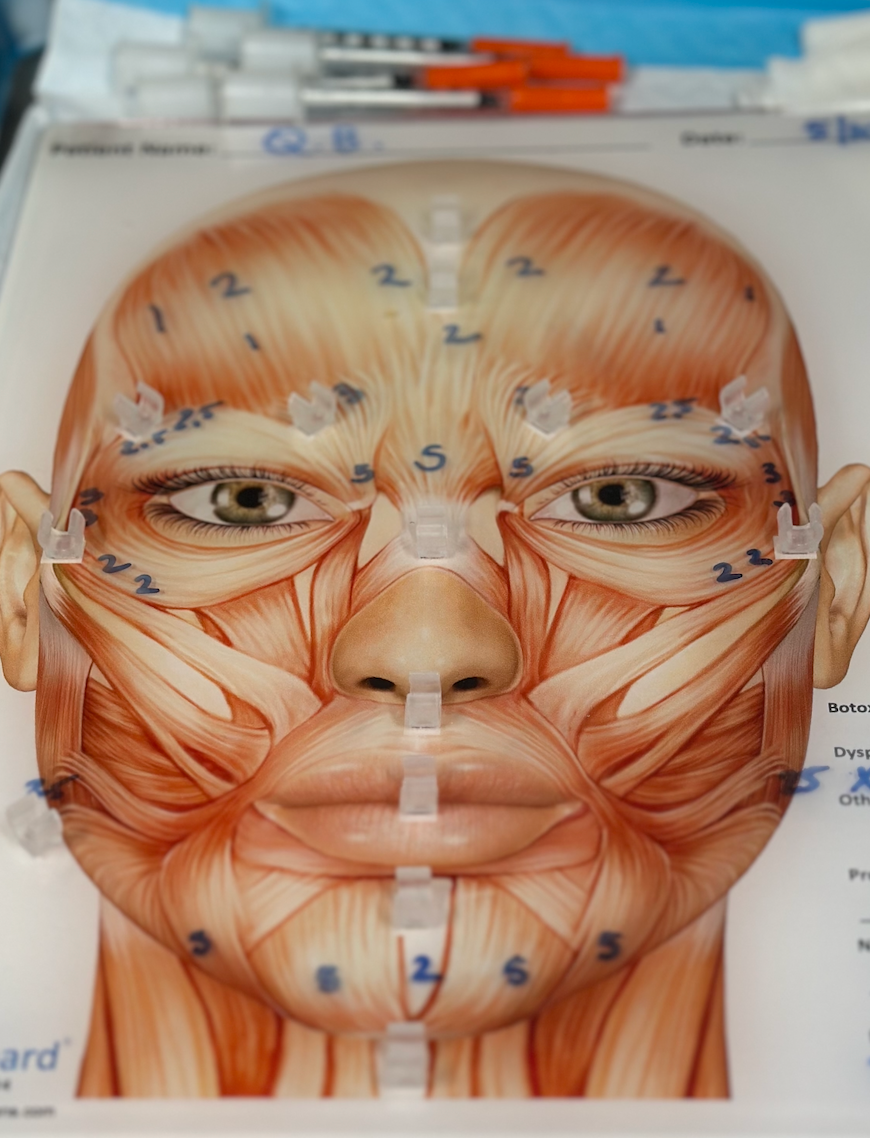 A diagram of the muscles on the human face